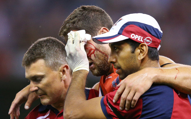 AFL look to cut out concussion injuries