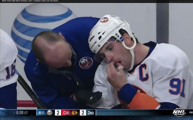 (Video) New York Islanders forward John Tavares pulls out his tooth