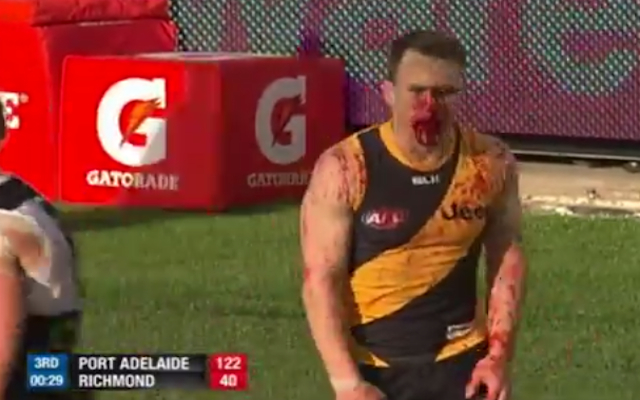 (Video) Ouch: Richmond’s Nathan Foley left bloodied after brutal clash with Port Adelaide’s Chad Wingard