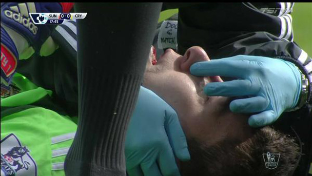 (Video) Sunderland vs Crystal Palace: Pantilimon left bloodied following painful collision